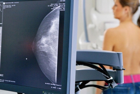 Mamografias poderão ser realizadas sem custos pelo IPE Saúde em outubro