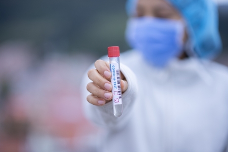 Planos de saúde são obrigados a cobrir testes rápidos - Veja como vai funcionar