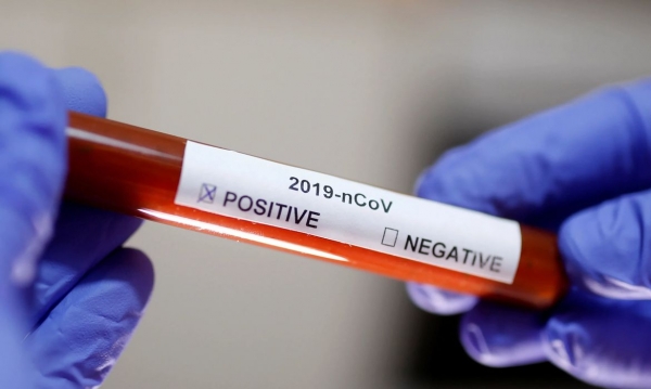 O município de Capão do Leão confirmou o primeiro caso positivo para Covid-19