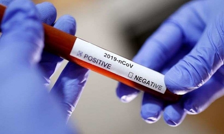 São Lourenço do Sul já realizou mais de 4 mil testes de Covid-19